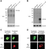 KCNMB1 Antibody in Western Blot (WB)