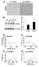 FABP4 Antibody in Immunocytochemistry (ICC/IF)