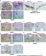 EphA2 Antibody in Immunohistochemistry (IHC)