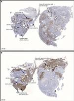 Cytokeratin 19 Antibody in Immunohistochemistry (Paraffin) (IHC (P))