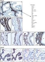 Cytokeratin 19 Antibody in Immunohistochemistry (IHC)