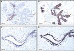 Cytokeratin 19 Antibody in Immunohistochemistry (IHC)