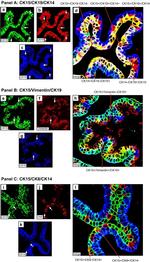 Cytokeratin 19 Antibody in Immunohistochemistry (IHC)