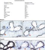 Cytokeratin 19 Antibody in Immunohistochemistry (Paraffin) (IHC (P))