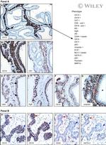 Cytokeratin 19 Antibody in Immunohistochemistry (IHC)