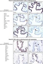 Cytokeratin 19 Antibody in Immunohistochemistry (IHC)