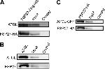 ATGL Antibody in Western Blot, Immunoprecipitation (WB, IP)