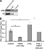 ATGL Antibody in Western Blot (WB)