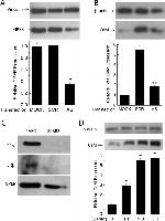 Estrogen Receptor alpha Antibody in Western Blot (WB)