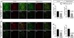 GAD65/GAD67 Antibody in Immunohistochemistry (IHC)