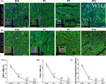 Cardiac Troponin T Antibody in Immunohistochemistry (IHC)