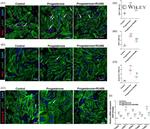 Cardiac Troponin T Antibody in Immunohistochemistry (IHC)