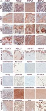 ASIC2 Antibody in Immunohistochemistry (IHC)