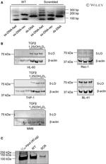 SP1 Antibody in Western Blot (WB)