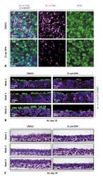 Cytokeratin 5 Antibody in Immunohistochemistry (IHC)