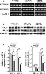 KCNMB1 Antibody in Western Blot (WB)