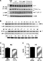 beta Amyloid Antibody in Western Blot (WB)