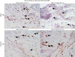 S100A1 Antibody in Immunohistochemistry, Immunohistochemistry (Paraffin) (IHC, IHC (P))