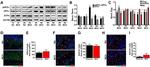 CHOP Antibody in Immunohistochemistry (IHC)