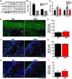 CHOP Antibody in Immunohistochemistry (IHC)