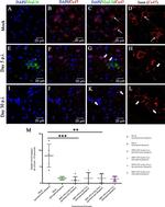 Connexin 47 Antibody in Immunocytochemistry (ICC/IF)