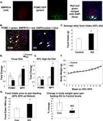 BMPR1A Antibody in Immunohistochemistry (IHC)