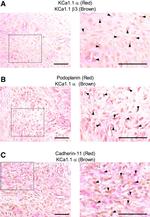 CDH11 Antibody in Immunohistochemistry (IHC)