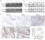 COL11A1 Antibody in Immunohistochemistry (IHC)