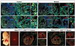 Cardiac Troponin T Antibody in Immunohistochemistry (IHC)