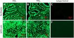 P2X7 Antibody in Immunohistochemistry (IHC)