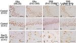 Estrogen Receptor beta Antibody in Immunohistochemistry (IHC)