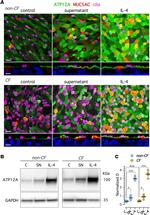 MUC5AC Antibody in Immunohistochemistry (IHC)