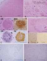 beta Amyloid (1-42) Antibody in Immunohistochemistry (IHC)