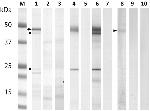 6x-His Tag Antibody in Western Blot (WB)