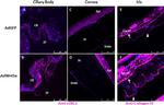 Collagen IV Antibody in Immunohistochemistry (IHC)