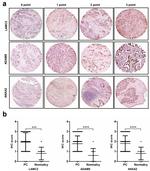 ADAM9 Antibody in Immunohistochemistry (IHC)