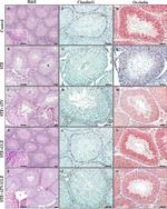 Occludin Antibody in Immunohistochemistry (IHC)