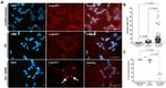 alpha Synuclein Antibody in Immunocytochemistry (ICC/IF)