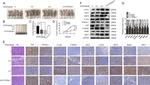 YAP1 Antibody in Immunohistochemistry (IHC)