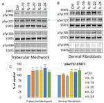 Phospho-STAT1 (Tyr701) Antibody in Western Blot (WB)