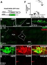 GnRH1 Antibody in Immunocytochemistry, Immunohistochemistry (ICC/IF, IHC)