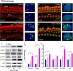 DDB2 Antibody in Western Blot (WB)