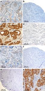 Claudin 3 Antibody in Immunohistochemistry (IHC)