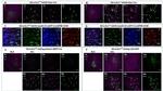 Glucocorticoid Receptor Antibody in Immunohistochemistry (IHC)