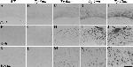 beta Amyloid Antibody in Immunohistochemistry (IHC)