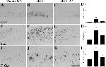 beta Amyloid Antibody in Immunohistochemistry (IHC)