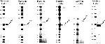 GABRA5 Antibody in Western Blot (WB)