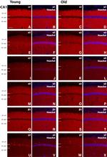 GABRA5 Antibody in Immunohistochemistry (IHC)