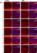 GABRA5 Antibody in Immunohistochemistry (IHC)