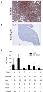 GLO1 Antibody in Immunohistochemistry (IHC)